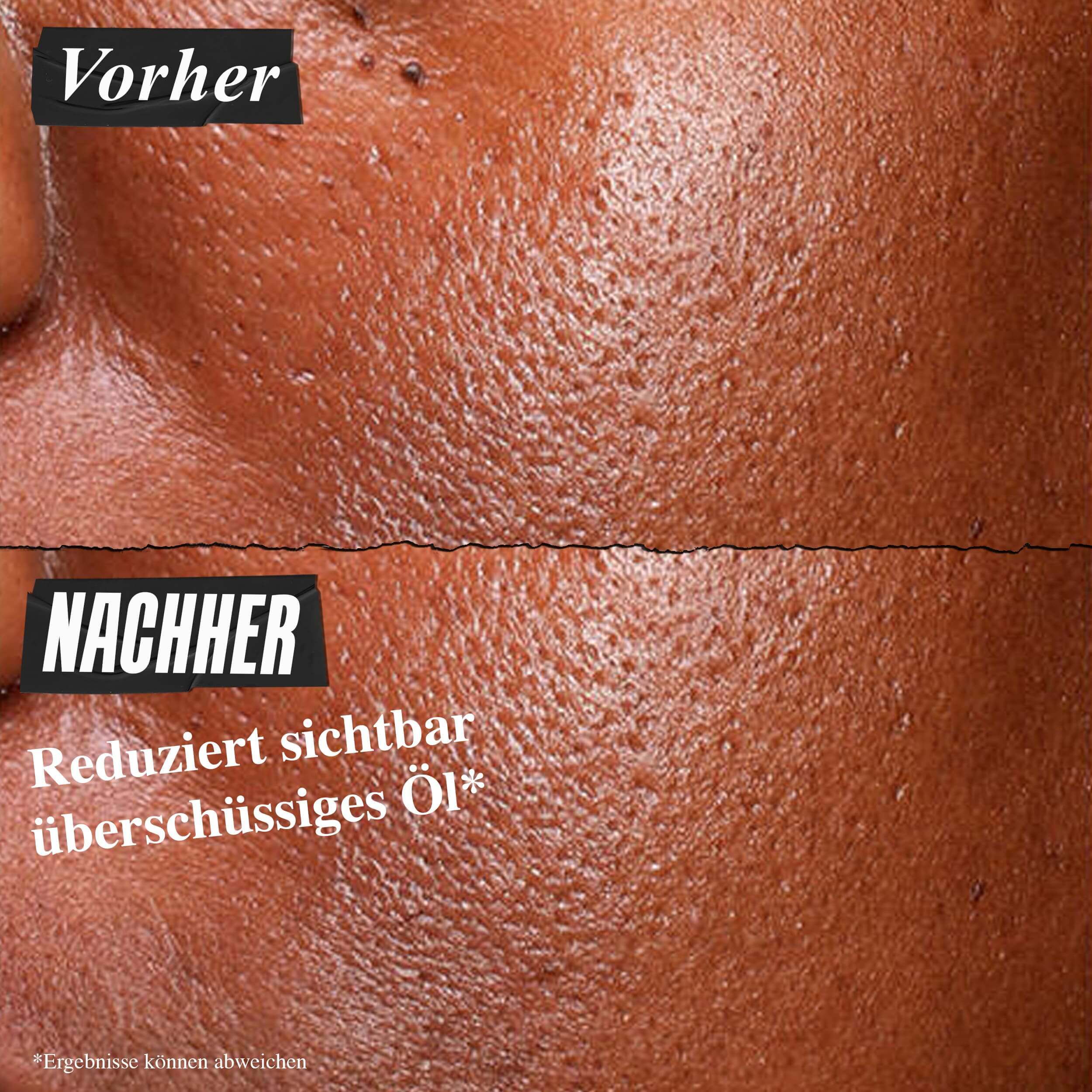 Vorher-Nachher-Foto des Kiehl's Ultra Pure High-Potency Serum zur sichtbaren Reduzierung von uberschussigem Hautfett