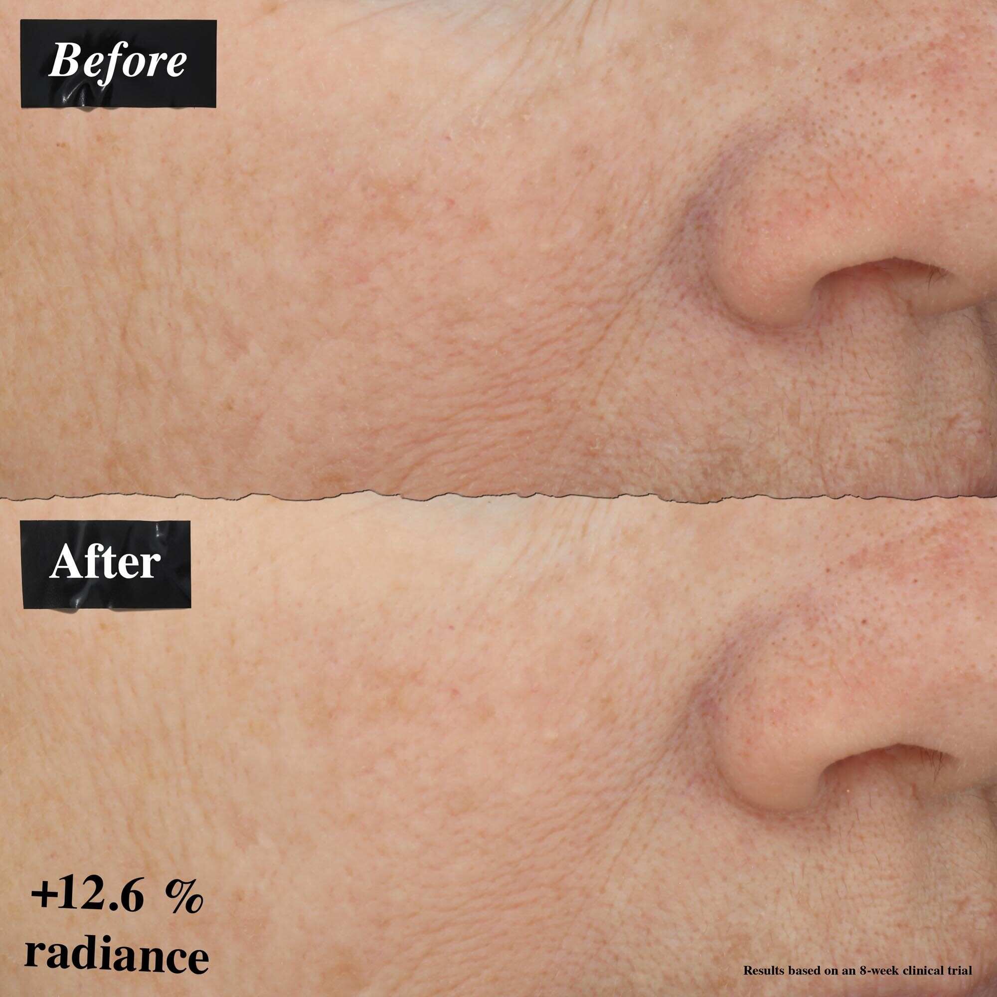 Ein Vorher-Nachher-Bildvergleich, der eine Verbesserung der Hautrotung nach der Anwendung von Powerful-Strength Line-Reducing Concentrate zeigt.