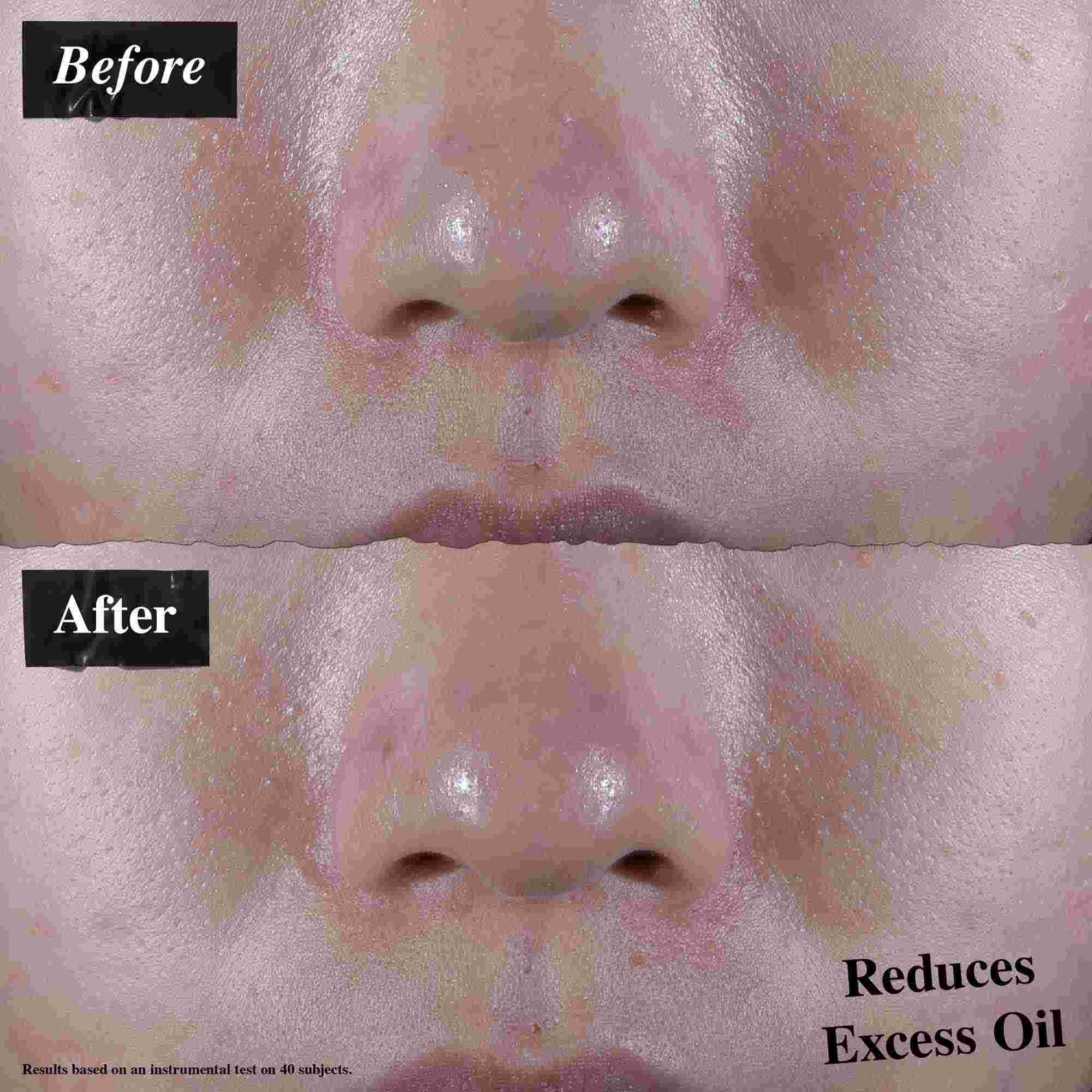 Ein Vorher-Nachher-Vergleich, der reduziertes uberschussiges Ol nach der Anwendung von Ultra Facial Oil-Free Gel Cream zeigt.