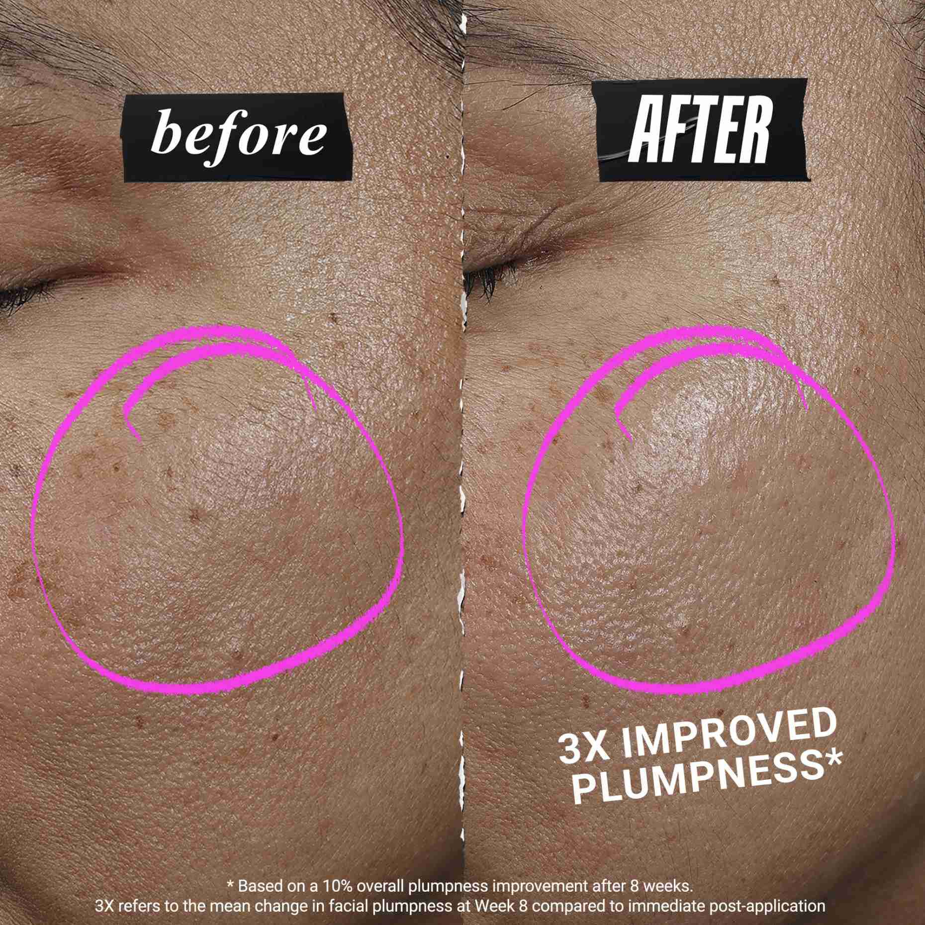 1cc* CollaShot Plump Serum