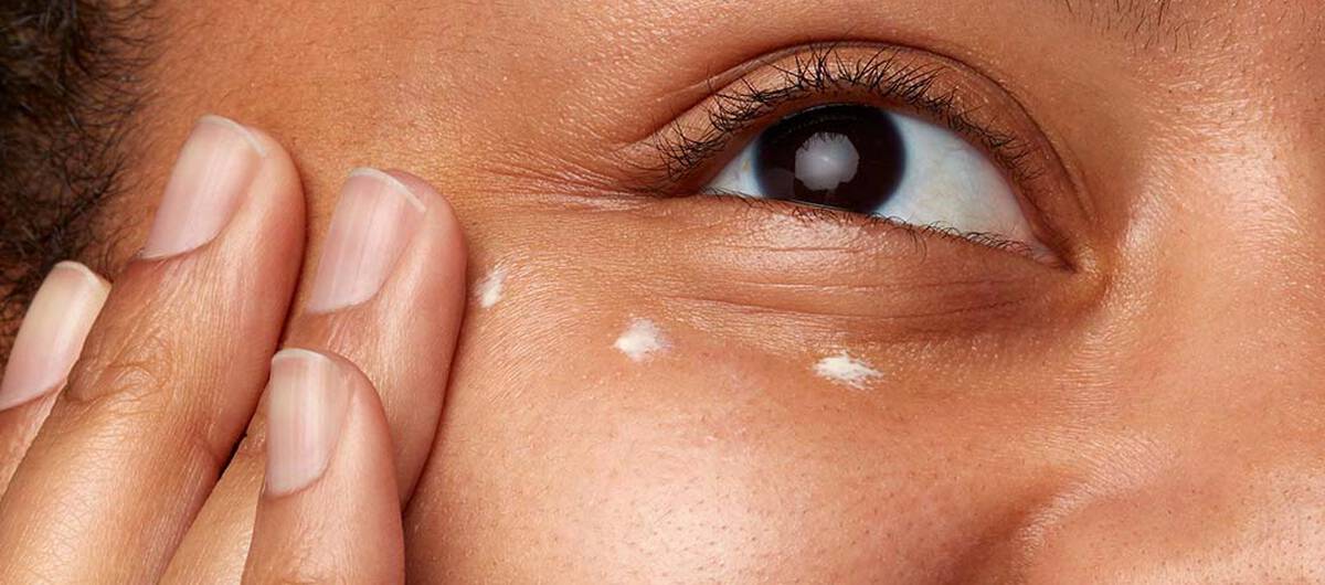 Gesicht ahnlicher Auswuchs eines Baumes