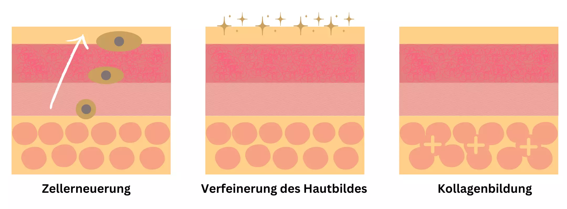 Dargestellter Querschnitt der Haut samt ihrer Prozesse