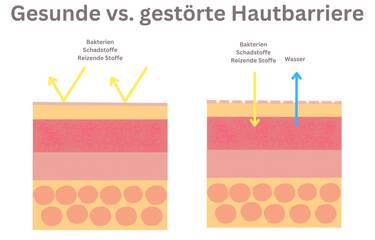 HAUTBARRIERE REPARIEREN: Stärkende Tipps | Kiehl's