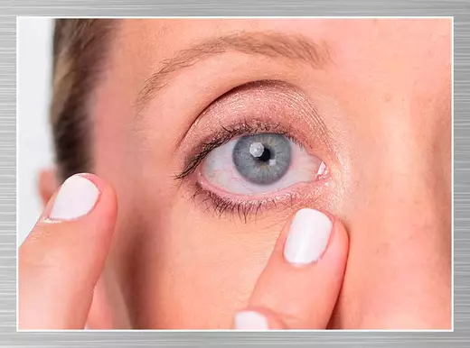Retinol und anderen Inhaltsstoffe