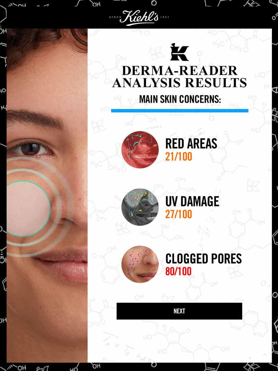 Derma Reader von Kiehl's: Schritt 3 der Hautanalyse