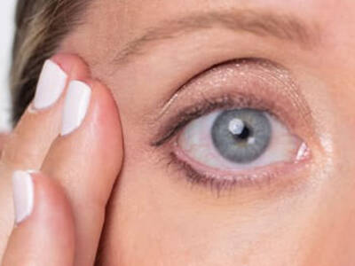 Auge mit Krahenfußen