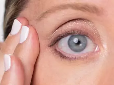 Auge mit Krahenfußen