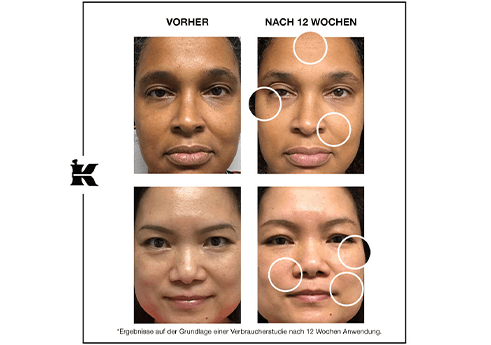 Retinol Skin-Renewing Daily Micro-Dose Serum Vorher-Nachher